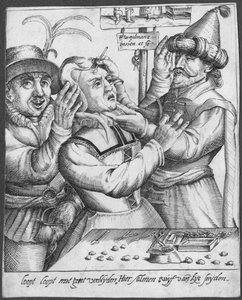 Trepanning, H. Weydmans metszete (XVI. század) alkotó: Dutch School
