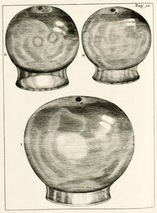 Különféle köpölyözéses poharak, Frederik Dekkers: The Practice of Medicine, 1694 alkotó: Dutch School