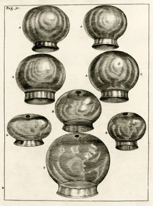Különféle köpölyözéses poharak, Frederik Dekkers: Az orvostudomány gyakorlata, 1694 alkotó: Dutch School