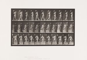 541. lemez. Cerebro-spinalis sclerosis multiplex (Choreic); Séta alkotó: Eadweard Muybridge