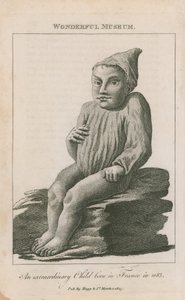 Rendkívüli gyermek született Franciaországban 1683-ban alkotó: English School