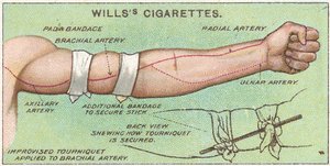 Tourniquet, 11. sz. a Willss Cigarettes kártya elsősegély-sorozatából, 1913 alkotó: English School