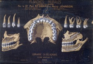 A fogak anatómiai fali diagramja alkotó: French School