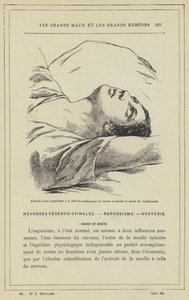 A hisztérikus hozzáállása a hozzáférés kataleptikus időszakában és a keresztre feszítés szakaszában (színes litho) alkotó: French School