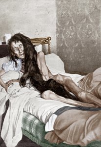 Blanche Monnier a kórházban, Poitiers, 1901. június (nyomtatás) alkotó: French School