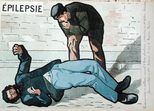 „Akut alkoholizmus okozta epilepsziás roham”, Dr. Galtier-Boissiere falikép az alkoholizmus veszélyeiről, 19. század vége. (színes litó) alkotó: French School