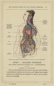 Vértermelő és keringési szervek klorotikus nőben (színes litho) alkotó: French School