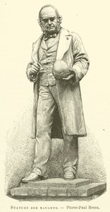 Tudósok szobrai, Pierre-Paul Broca (metszet) alkotó: French School