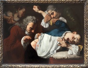 Művelet. Gaspare Traversi festménye (kb. 1722-1770), olaj, vászon, kb. 1753-1754. Olasz művészet 18. század. Staatsgalerie Stuttgart (Németország).