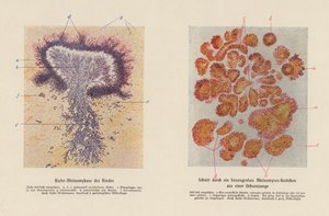 Actinomyces bovis (színes litográfia) alkotó: German School