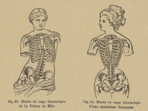 A Venus de Milo mellkasának és bordájának formájának összehasonlítása egy 19. század végi francia társasági emberével alkotó: German School