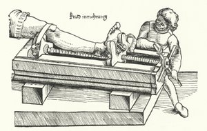 Készülék a sérült láb kiegyenesítésére (gravírozás) alkotó: German School