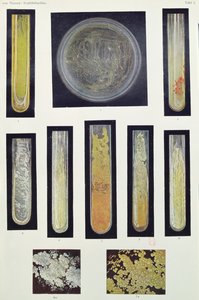 Syphilis Bacillus, Max von Niessen könyvéből, Lipcse, 1908 alkotó: German School