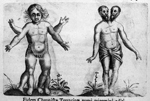 Különféle típusú emberi szörnyek Metszet Fortunio Norsi (1577-1656) olasz tudós "A szörnyek természete, okaik és különbségeik" című könyvéből. 1646 alkotó: Italian School