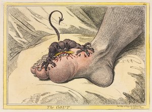 A köszvény alkotó: James Gillray