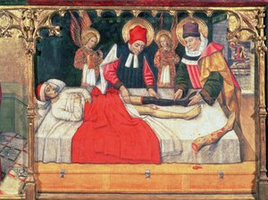 126-0035321 SS. Cosmas és Damian egy etióp férfi lábát oltják Justinianus diakónus csonkjára;
