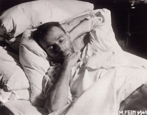Egon Schiele a halálos ágyán, 1918. alkotó: Martha Fein