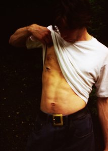 Seb alkotó: Mat Collishaw