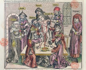 Simon tridenti mártíromsága, a Liber Chronicarum Mundi című, 1493-ban Nürnbergben kiadott kötet fametszete után.