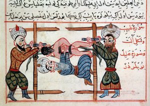 A törés csökkentése. Miniatűr Sharaf al-din egy csemegéből a török orvoslásból alkotó: Ottoman School