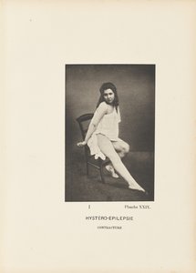 Hystero-epilepsziás kontraktúra alkotó: Paul Marie Léon Regnard