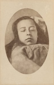 A hisztéria támadása, második fázis, illusztráció a Bourneville et P. Regnard „Iconographie Photographique de La Salpetriere” című művéből, III. tábla, Párizs, 1876 (albumnyomat) alkotó: Paul Regnard