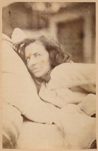 Hisztérikus epilepszia, delírium, vágy, XXXVI. lemez az „Iconographie Photographique de La Salpetriere”-ből, Bourneville és P. Regnard, Párizs, 1876 (albumnyomat)