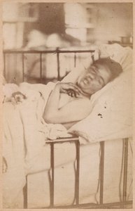 Hisztérikus epilepszia, állandó összehúzódás, XXVIII. lemez a Bourneville et P. Regnard által készített "Iconographie Photographique de La Salpetriere"-ből, Párizs, 1876 (albuminnyomat).