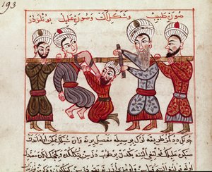 Orvostudomány: ortopédiai beavatkozás. Miniatűr, amelyet Charaf-ed-din (Charaf ed Din) (1404-1468) a török orvoslás fejéséből vett a „” La Surgery Imperiale” után” (Ms Sup Turk 693 fol. 193) 1466 Paris, B.N. alkotó: Persian School