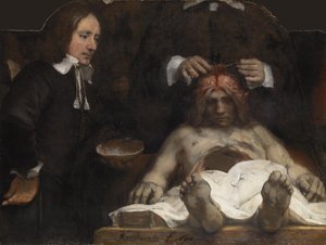 Dr. Jan Deyman anatómiai leckéje, 1656 alkotó: Rembrandt van Rijn