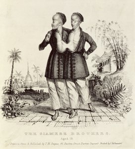 A sziámi testvérek, 18 évesek, nyomtatta Charles Hullmandel (1789-1850), 1829 körül