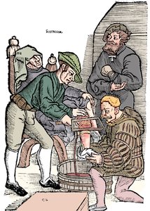 Láb amputációja érzéstelenítés nélkül, 1593 alkotó: Unbekannt
