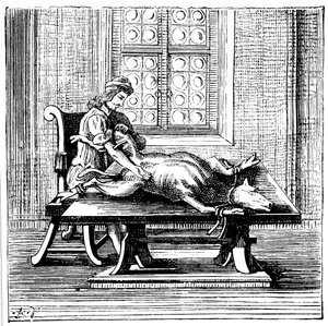 Állat-ember vérátömlesztés, 1679 alkotó: Unbekannt