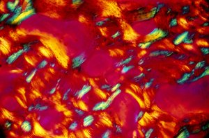 BIO-ANYAGOK, LM Csont alkotó: Unbekannt