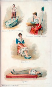 Hidroterápiás kezelések, c1902 alkotó: Unbekannt