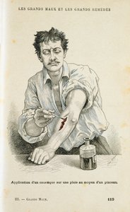 Sebfestés antiszeptikus oldattal, c1890 alkotó: Unbekannt