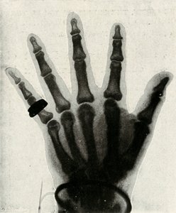 H.R.H. kezének röntgenfelvétele A walesi herceg, 1897 alkotó: Unbekannt