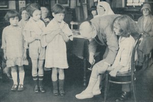 A patella reflex tesztelése idegbetegség jeleként, c1935 alkotó: Unbekannt