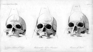 Háromféle emberi koponya, 1848 alkotó: Unbekannt