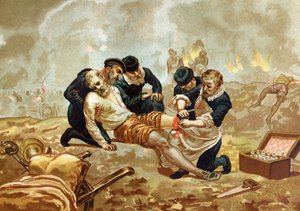 Ambroise Pare Medicine és francia sebész (1509-1590 körül) az artériák amputáció utáni lekötésével foglalkozik. a híres férfiak és nők után. Barcelona 1877. alkotó: Unknown artist