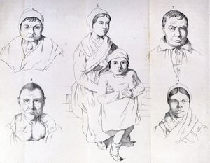 Morel megfontolások az endemikus kreténizmus okairól. alkotó: Unknown artist