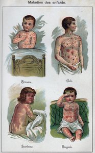 Gyermekek betegségei: csalánkiütés, kanyaró, rüh, skarlát. F.E. Bilz „Az új természetes gyógyszer” című könyvében. alkotó: Unknown artist