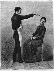 Hipnózisjelenségek: a hipnózist úgy idézik elő, hogy hirtelen kinyújtják a kezét a páciens elé. Metszet 1881-ből. alkotó: Unknown artist