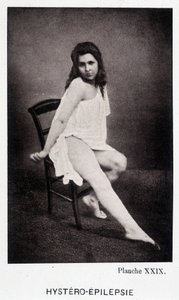 Hystero Epilepsia – kontraktúra a Salpétrière fényképészeti ikonográfiájában: Mr. Charcot szolgálata, Paul Regnard és Bourneville alkotó: Unknown artist