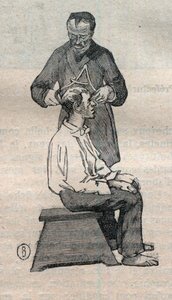 Bírói antropometria vagy bertillonnage, Alphonse Bertillon (1853-1914) módszere: a koponya keresztirányú átmérőjének mérése - Gravírozás „” La Science francaise”-ban alkotó: Unknown artist