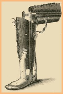 Láb cseréje alkotó: Unknown Artist