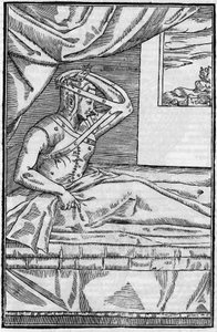 Orrműtét: Helyreállító műtét az orron a „De curtorum chirurgia per insitionem”-ben. Velence alkotó: Unknown artist