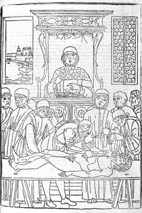 Anatómiai boncolás. Metszet Gerolamo Cardano (Cardanus Hieronymus) orvostudományi értekezéséből, Firenze alkotó: Unknown artist