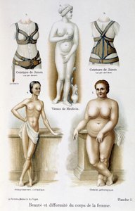 A női test szépsége és deformitása (soványság és elhízás); Juno övei – A nő, házi orvos alkotó: Unknown artist