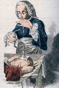 A Trepanáció. 18. századi nyomtatvány. alkotó: Unknown artist